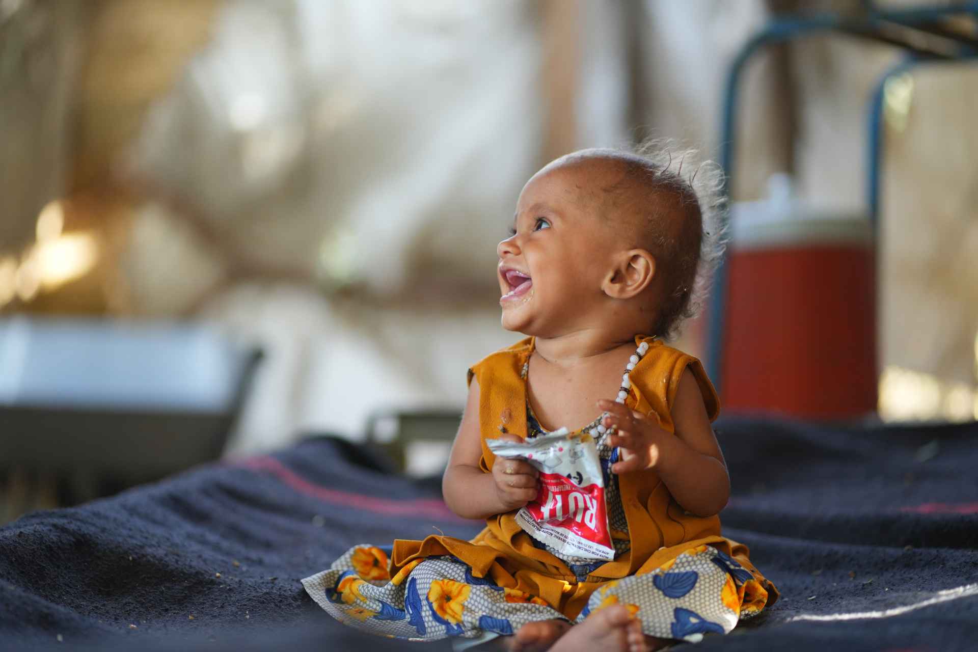 Bebé sonriendo tratamiento nutrición Yemen