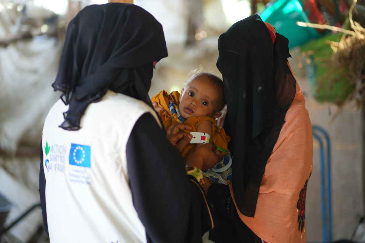 Bebé en brazos tratamiento nutrición Yemen